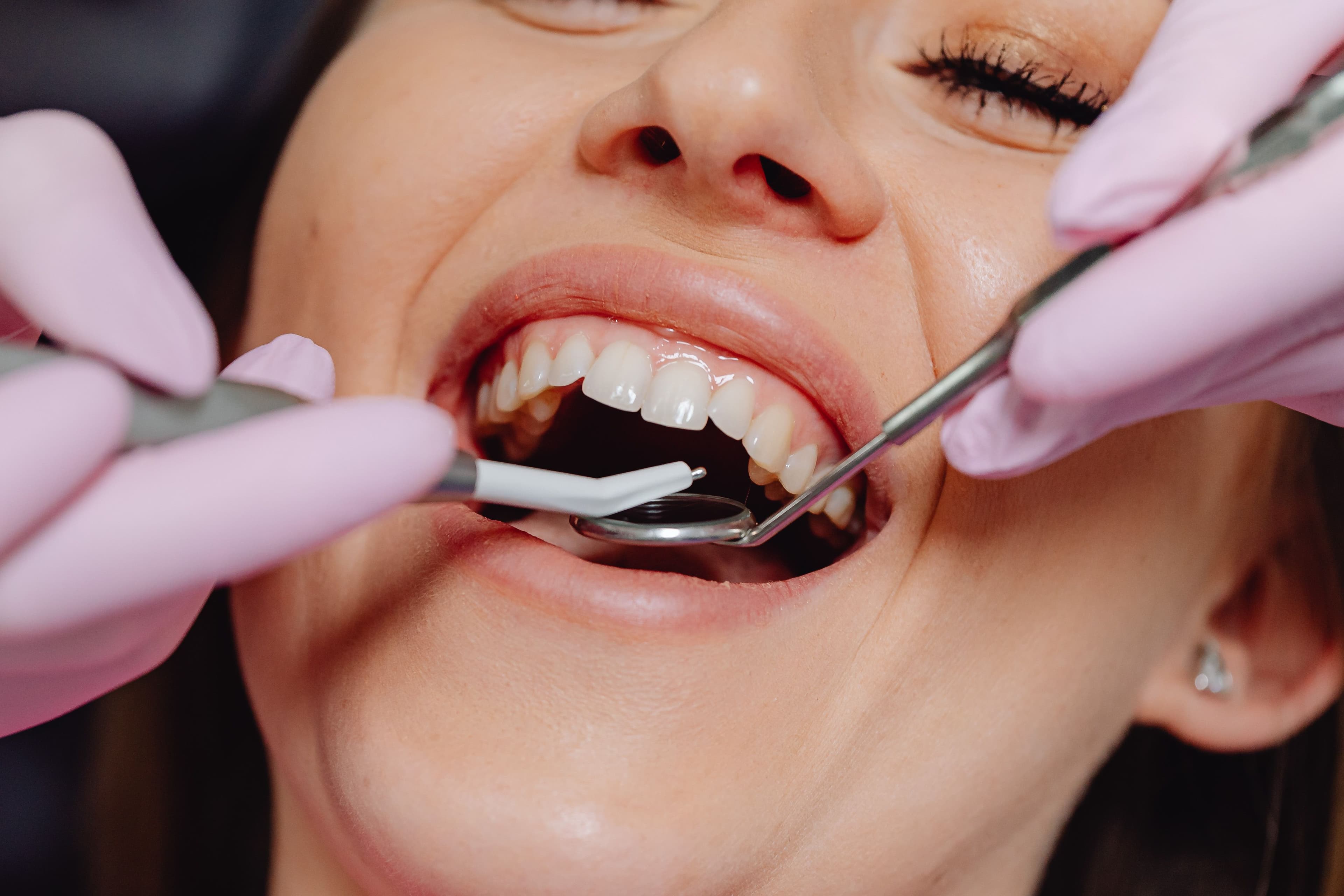 Early Symptoms of Gum Disease You Should Never Ignore